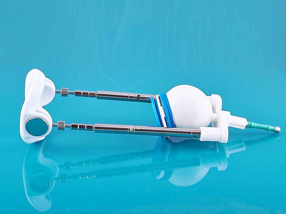 The extender will help to improve the result of ligamentotomy