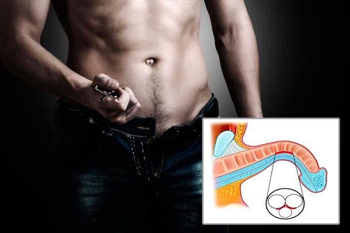 A man deprives his flight for penis expansion exercises