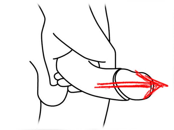 Penis stretching for expansion